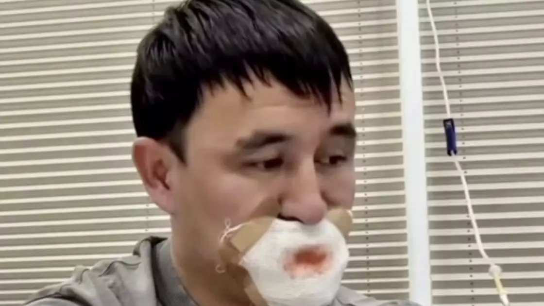 Қызбен сүйісемін деп тілінен айрылып қалған жігіт туралы сұмдық хабар тарады