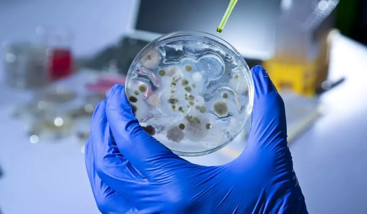 В Актюбинской области взяли почти тысячу проб почвы на сибирскую язву: что показали результаты