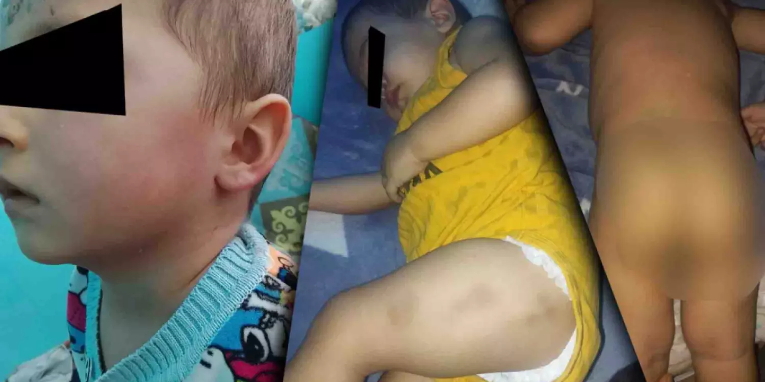 Жаркентте баласын ұрған әйел мен күйеуінің жағдайына қатысты тың дерек шықты