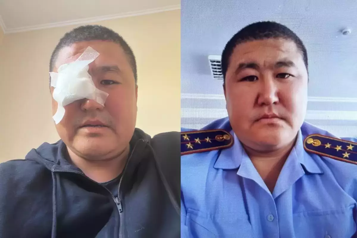 Шымкентте полицей оқу-жаттығу кезінде бір көзінен айырылған