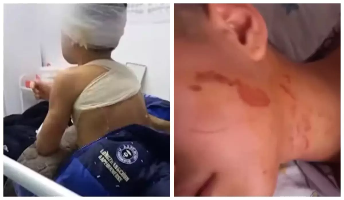 “Үтікпен күйдіріп, ауыздарына қыздырылған шанышқы басқан”: Шымкентте әйел туған балаларына қорлық көрсетіп келген