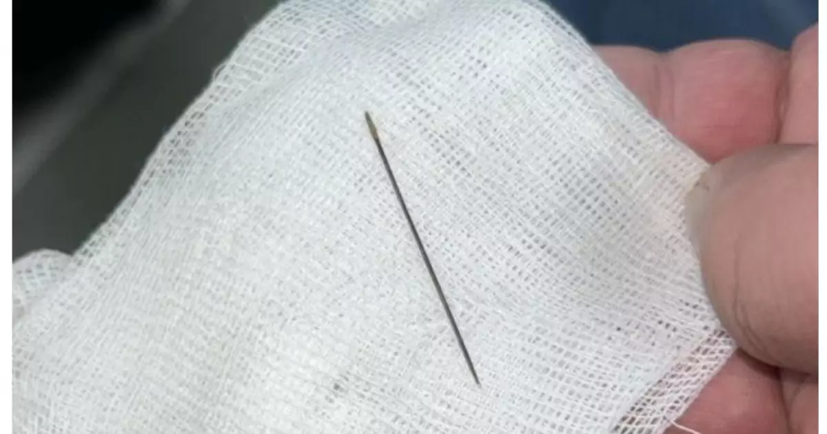  Түркістанда 8 айлық сәбидің ішкі құрылысынан ине табылды 