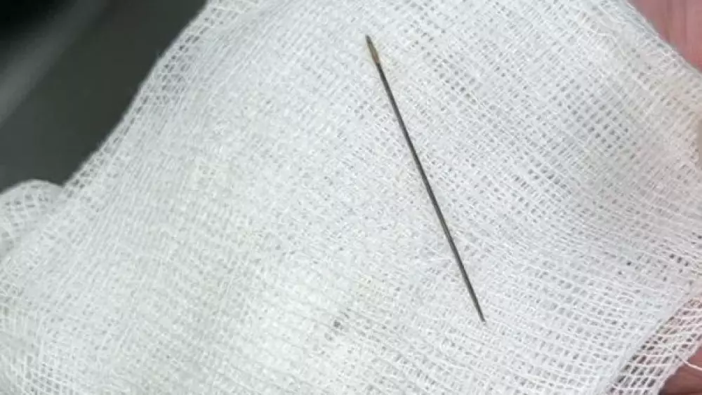 Иглу обнаружили врачи в теле 8-месячного ребёнка в Туркестане