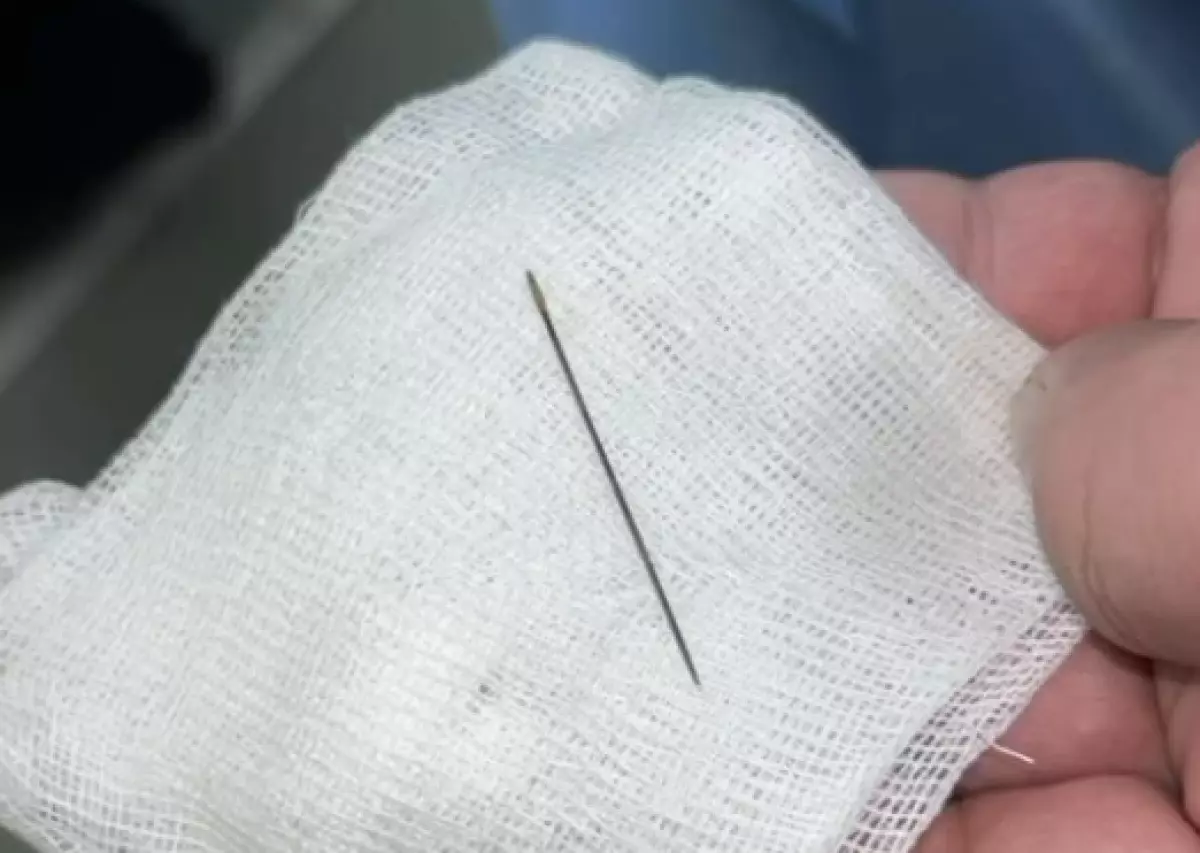 Младенцу извлекли иглу из печени в Туркестане