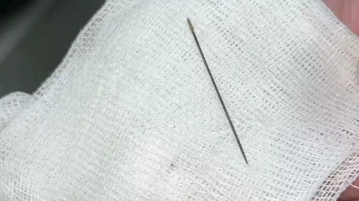 Қазақстанда 8 айлық сәбидің ішінен ине табылды