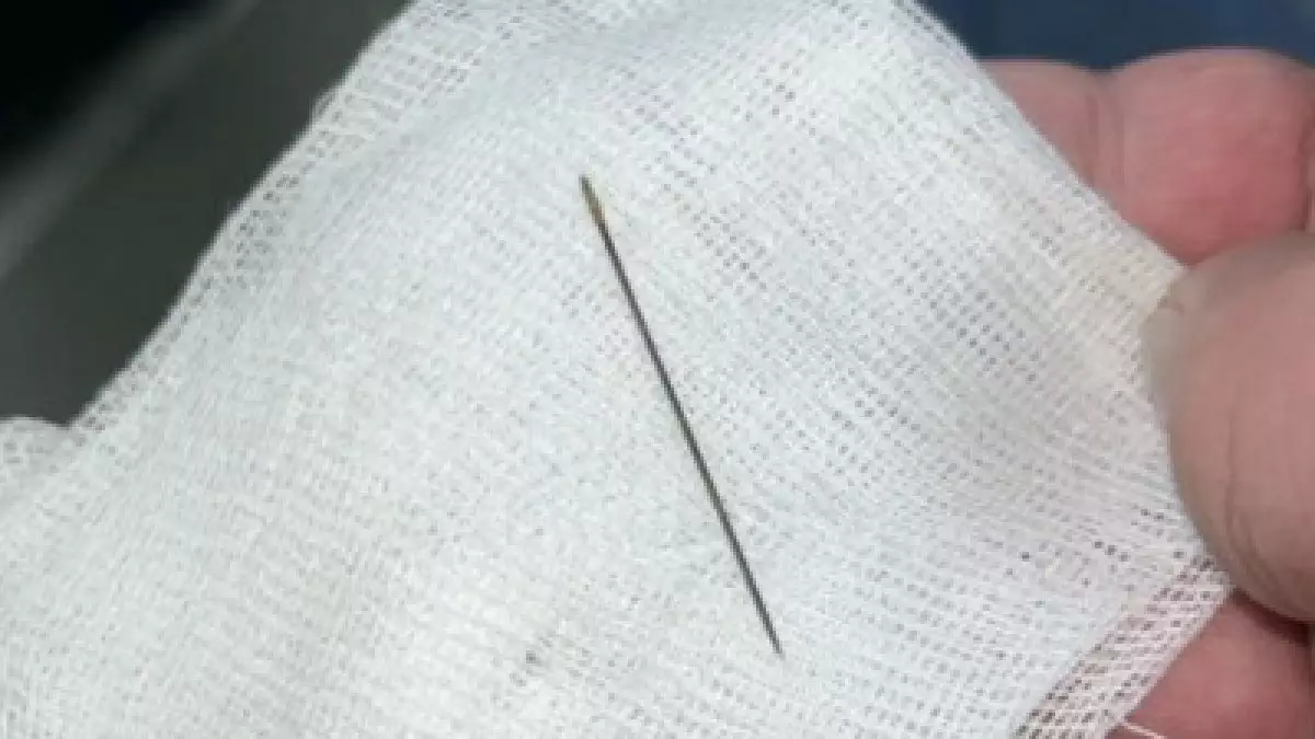 Түркістанда 8 айлық сәбидің ішінен ине табылды