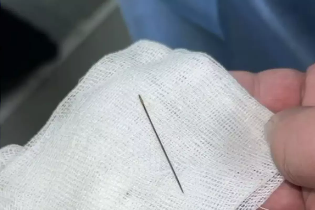 Врачи Туркестана извлекли иглу из младенца