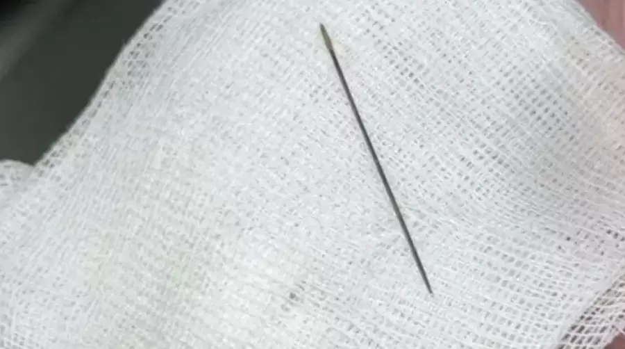 Түркістанда 8 айлық cәбидің ішінен ине табылды