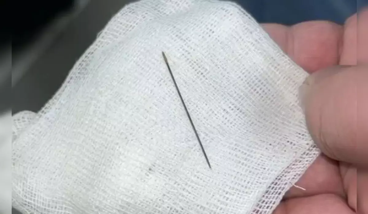 Иглу нашли в брюшной полости 8-месячного ребенка в Туркестане (ВИДЕО)