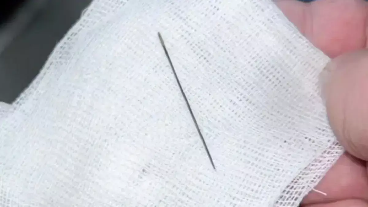 Медики в Казахстане извлекли иглу из восьмимесячного ребенка - новости на Lada.kz 24.01.2026