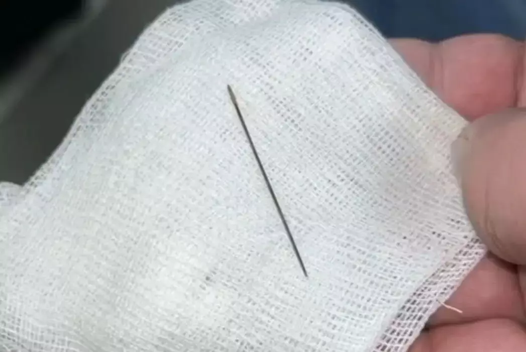 Врачи спасли 8-месячного младенца с иглой в брюшной полости в Туркестане