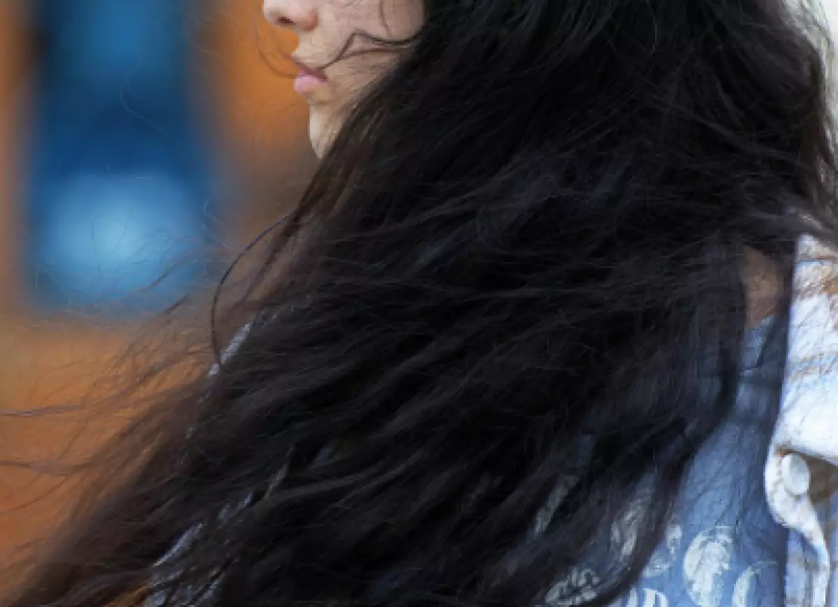 Ком волос весом 1,4 кг обнаружен в желудке девушки из Узбекистана