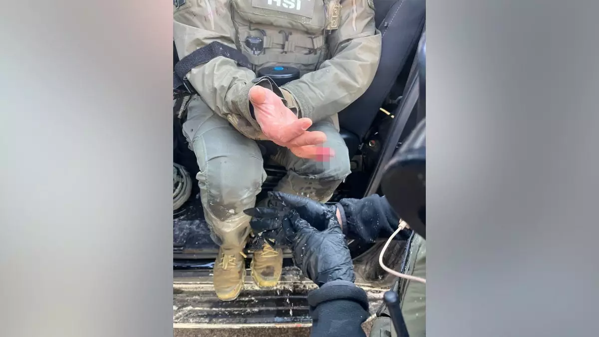 Активист движения против ICE в Миннеаполисе, как утверждается, откусил палец федеральному офицеру во время нападения.