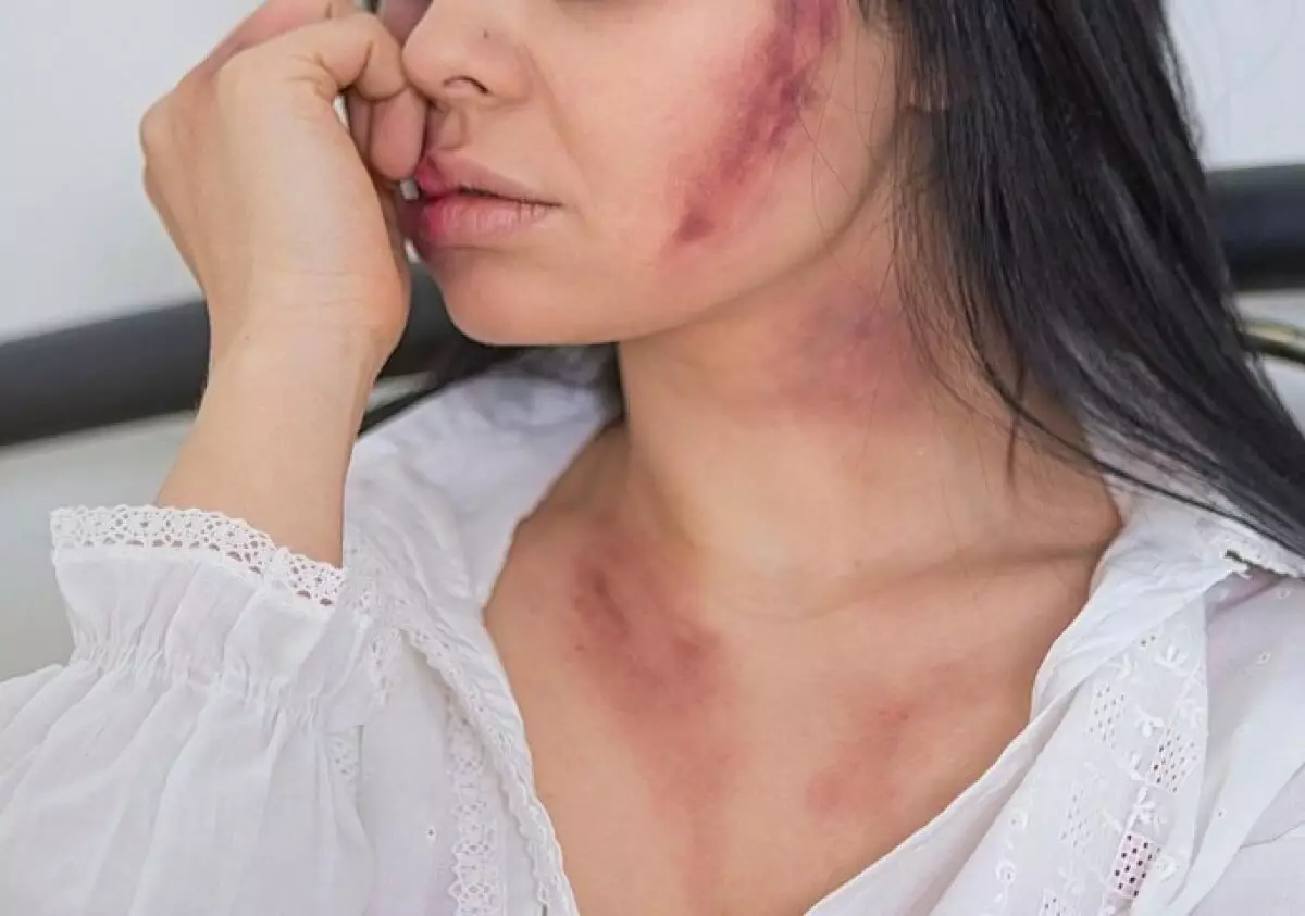 Случайное знакомство в парке закончилось жестоким избиением и тюрьмой в Актобе