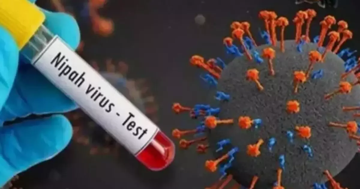  Емі жоқ вирус. Денсаулық сақтау министрлігі шұғыл мәлімдеме жасады 