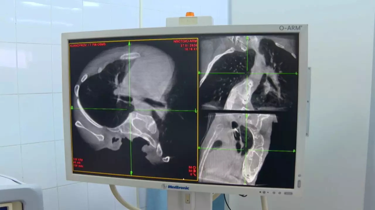 Тегін жасалатын күрделі операциялардың саны артты