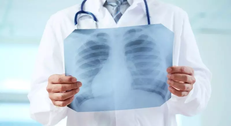 Два случая туберкулеза выявлены среди студентов в СКО