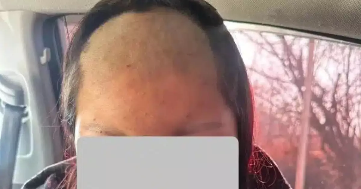  Кәмелетке толмаған қызды ұрып-соғып, шашын қырып тастаған (ФОТО) 