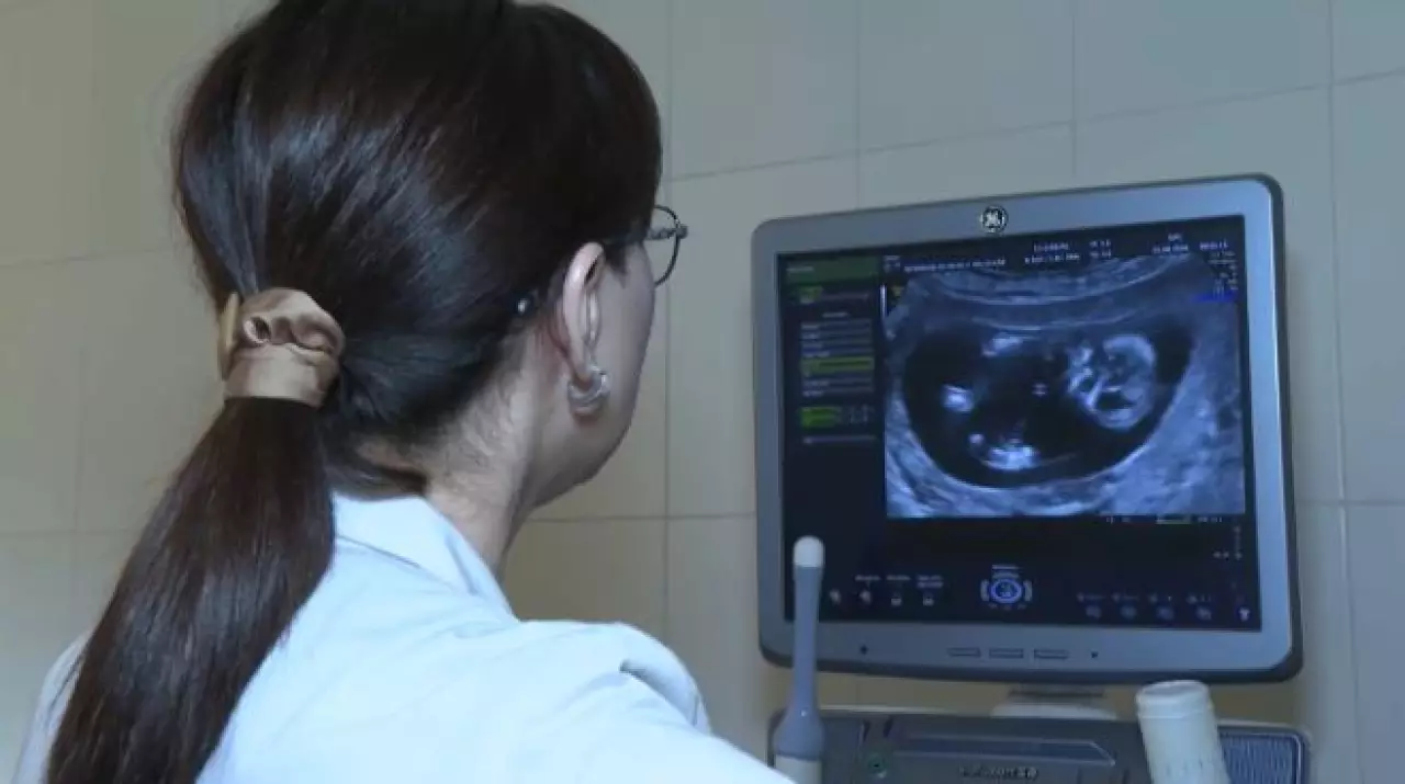 Какие программы в Казахстане есть для женщин, планирующих беременность