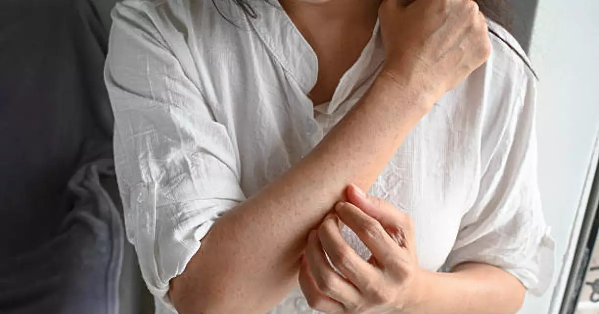  Теріңіз жиі қыши ма? – бауырыңызды тексерткеніңіз жөн 