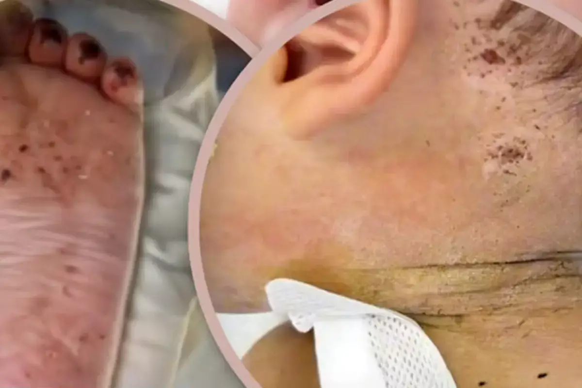 Мать исколола ребенка иглами за плохое поведение - новости на Lada.kz 31.01.2026