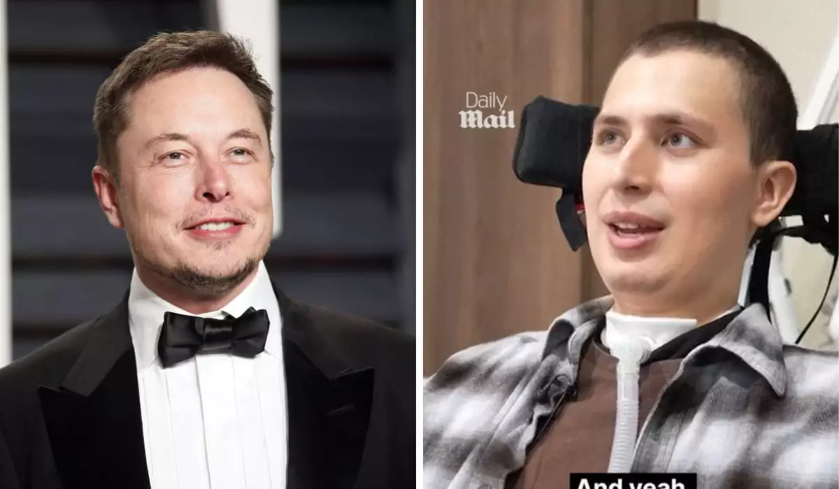 21 жасында сал болып қалған ұлыбританиялық Илон Масктің ми чипімен қалай өмір сүріп жатқанын айтып берді