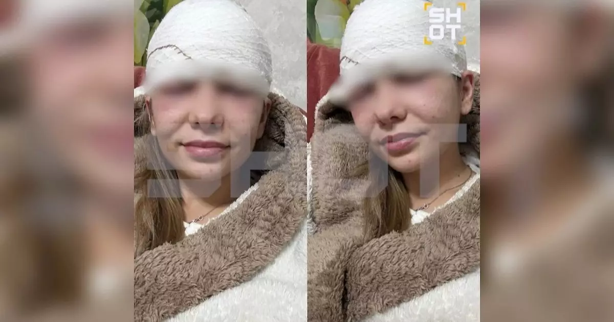  `Безеуін сығамын деп өмірінен айрылып қала жаздады`: 28 жастағы келіншек адам сенгісіз жағдайға түсіп қалды (ФОТО) 