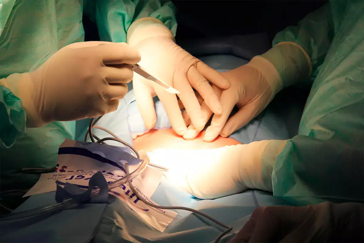 Врачи были ошеломлены: в организме француза нашли снаряд столетней давности - новости на Lada.kz 02.02.2026