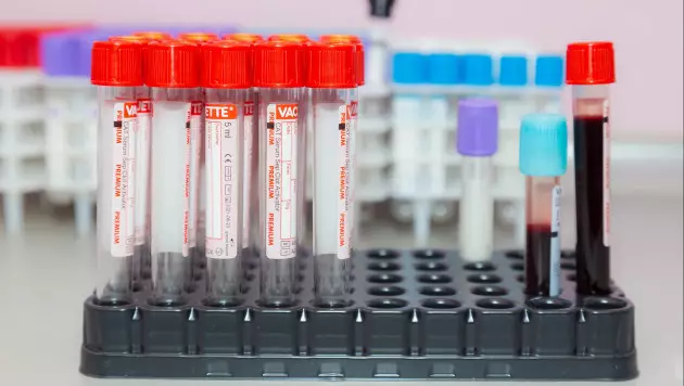 Первый скандал перед ОИ-2026: обнаружена положительная допинг-проба