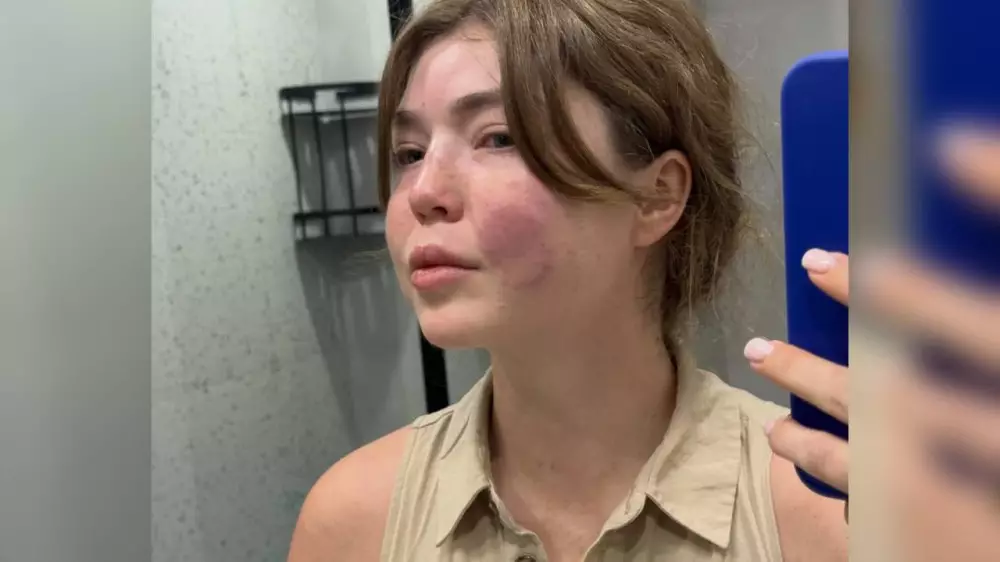 “Избил и не дал вызвать скорую“: жена обвинила алматинского бизнесмена