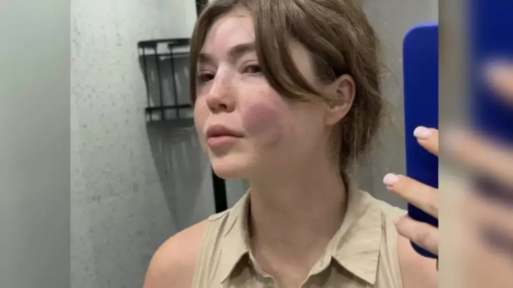 “Соққыға жығып, жедел жәрдем шақыртпаған“: әйелі кәсіпкер күйеуін айыптады