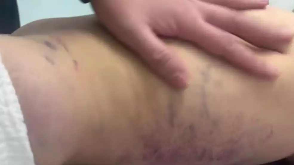 "Әлем оны әкесі соққыға жығу үшін құтқарған жоқ": Жәбірленген 3 жасар қыз туралы жаңа деректер пайда болды