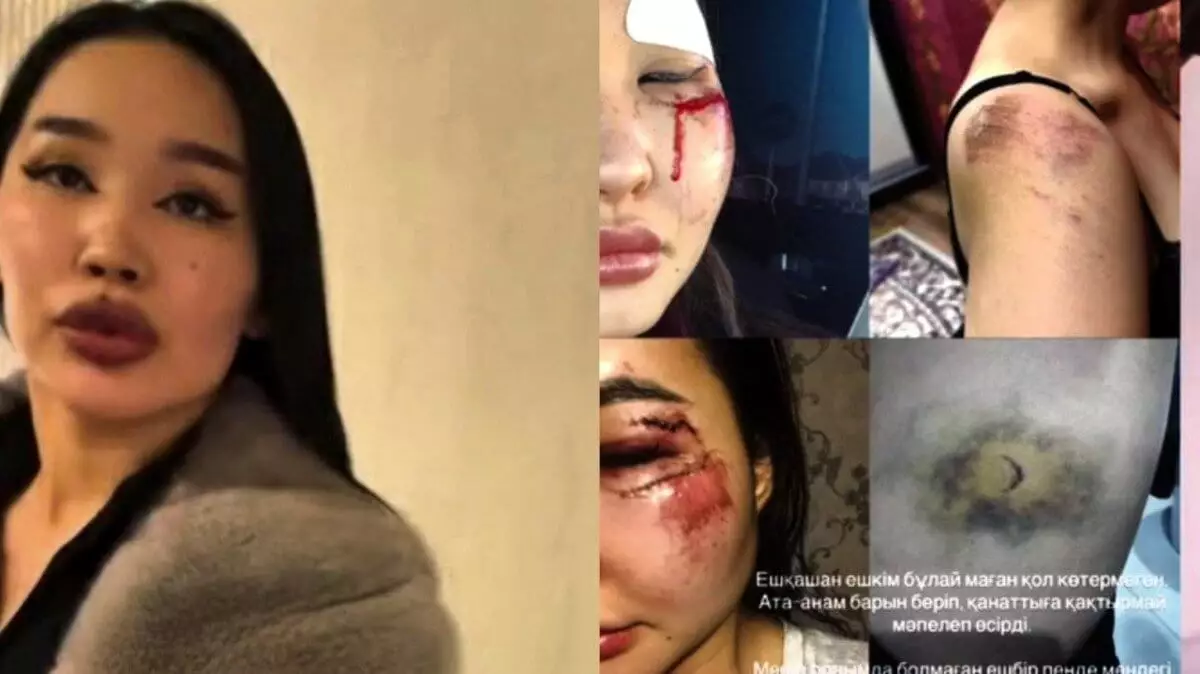 Атырауда блогерді ұрып, үйқамаққа қамалған күдіктінің ойын-сауық орнында жүргені анықталды