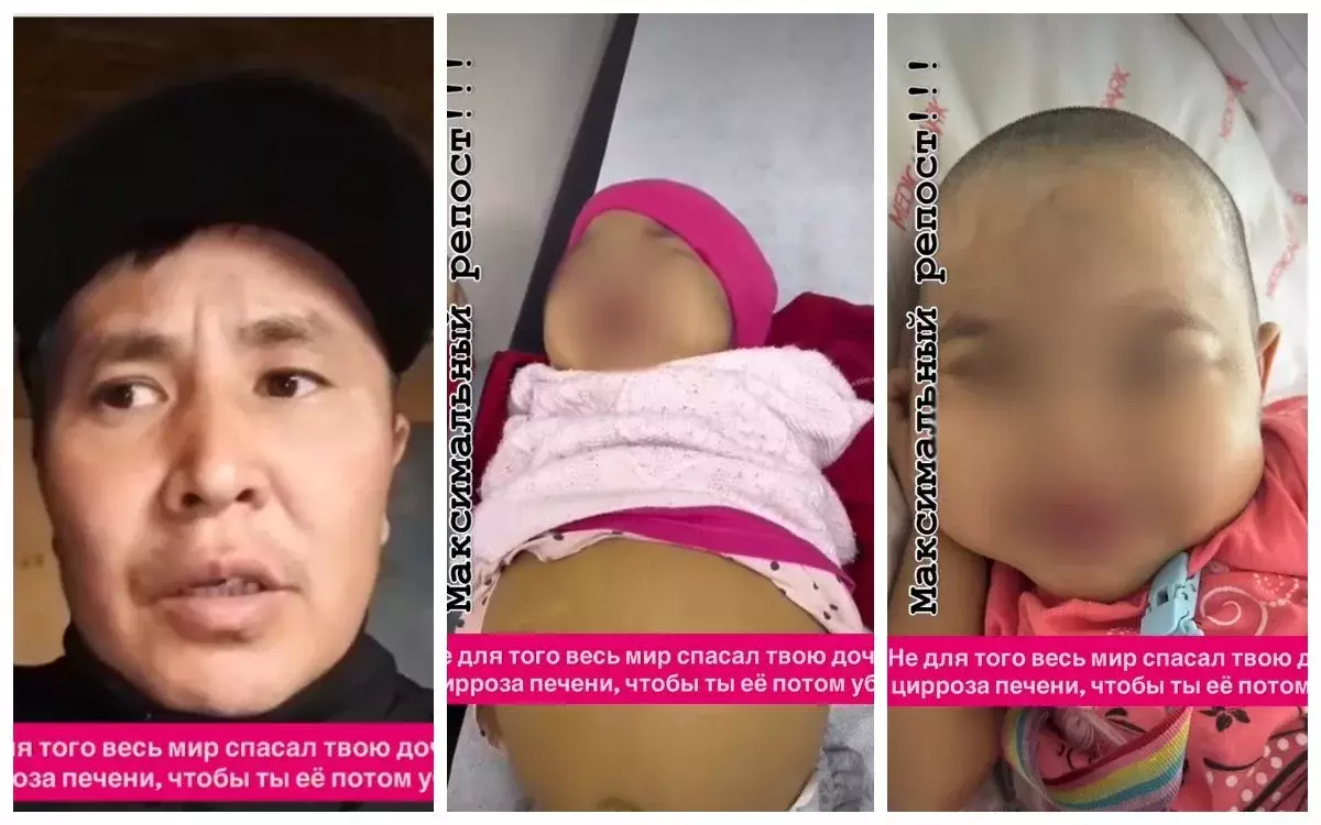 «Бауыр трансплантациясы жасалған»: Талдықорғанда әкесі сабаған бала жайлы тың дерек (ВИДЕО)