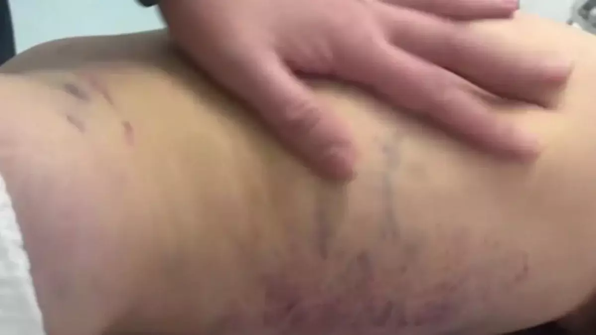 «3 жасар қызы мен әйелін көкала қойдай сабаған»: Баланың жағдайы белгілі болды