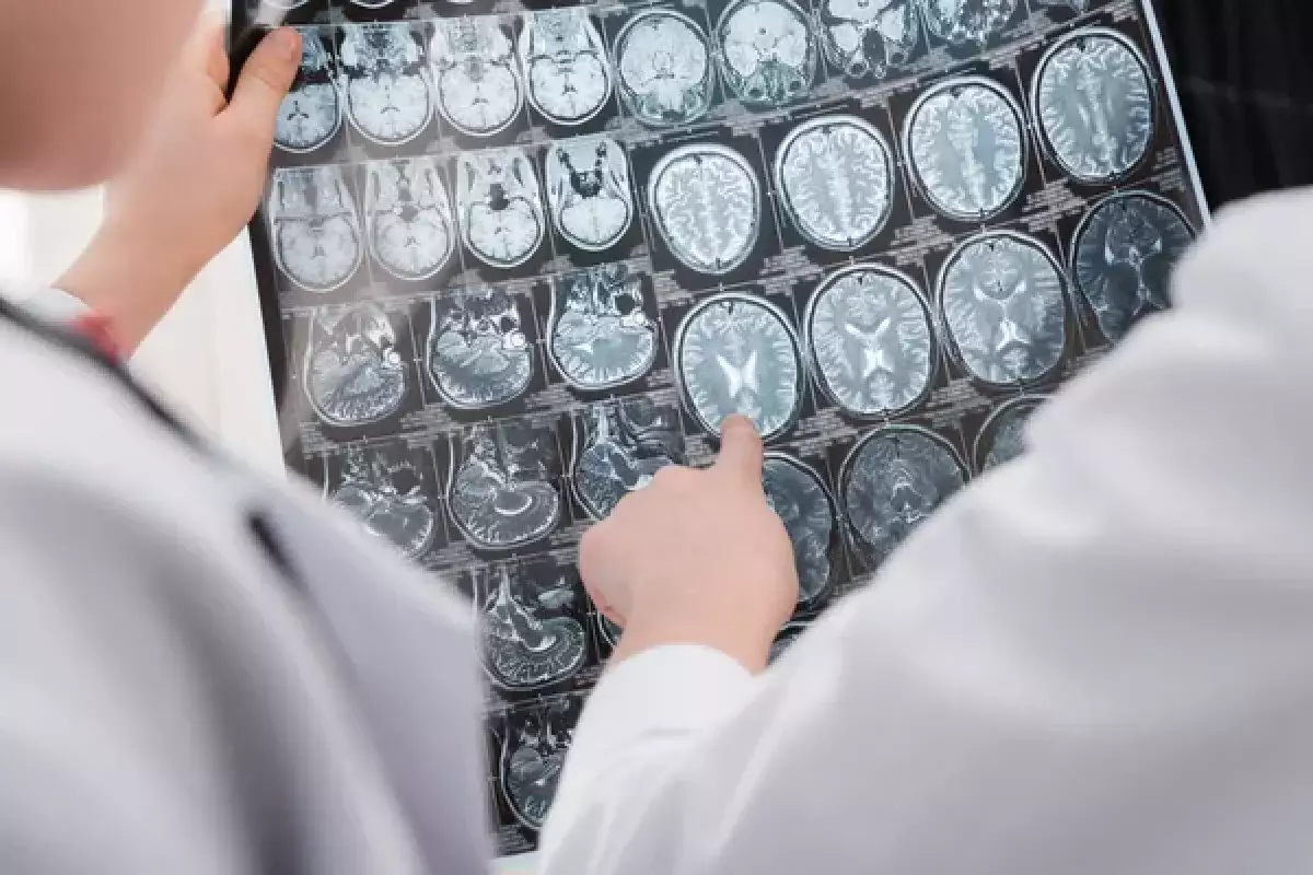 Ученые назвали группу крови, носители которой чаще бывают гениями