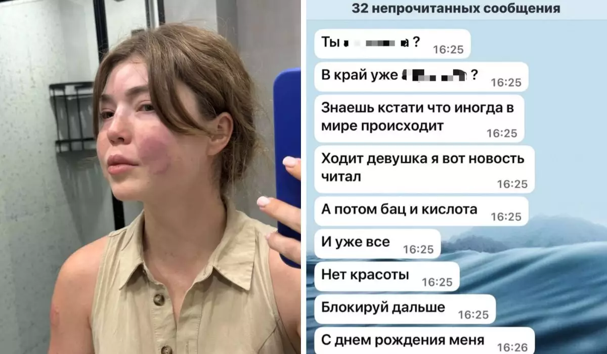 "Ұрып-соғып, жедел жәрдем шақыртпады": Қазақстандық актриса тұрмыстық зорлық-зомбылық көргенін айтты