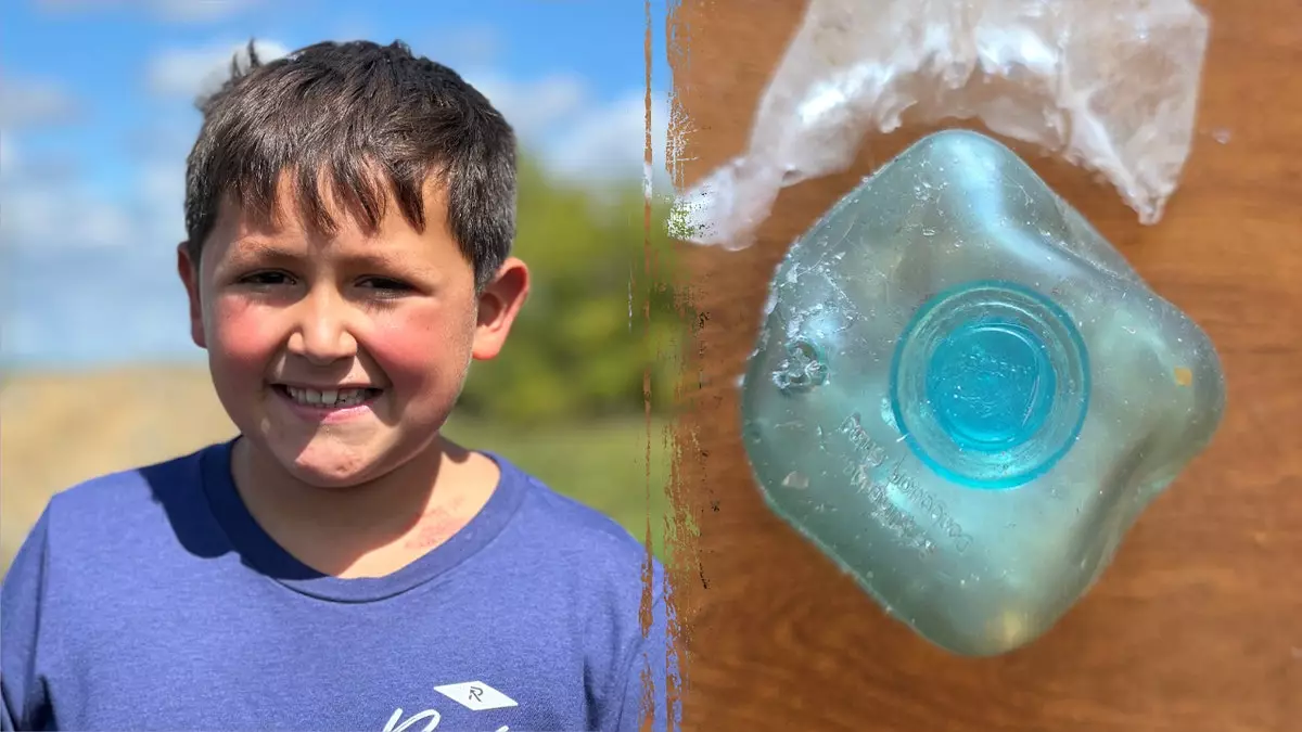 Опасный тренд в TikTok привел к тяжелым ожогам у мальчика, и врачи предупредили об этом.