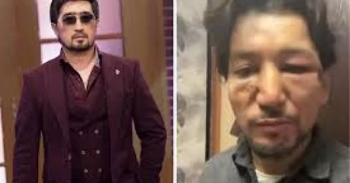  `Өлтіріп қояма деп қорықтым`: Мұқасан Шахзадаевтан таяқ жеген әнші сұхбат берді (ВИДЕО) 