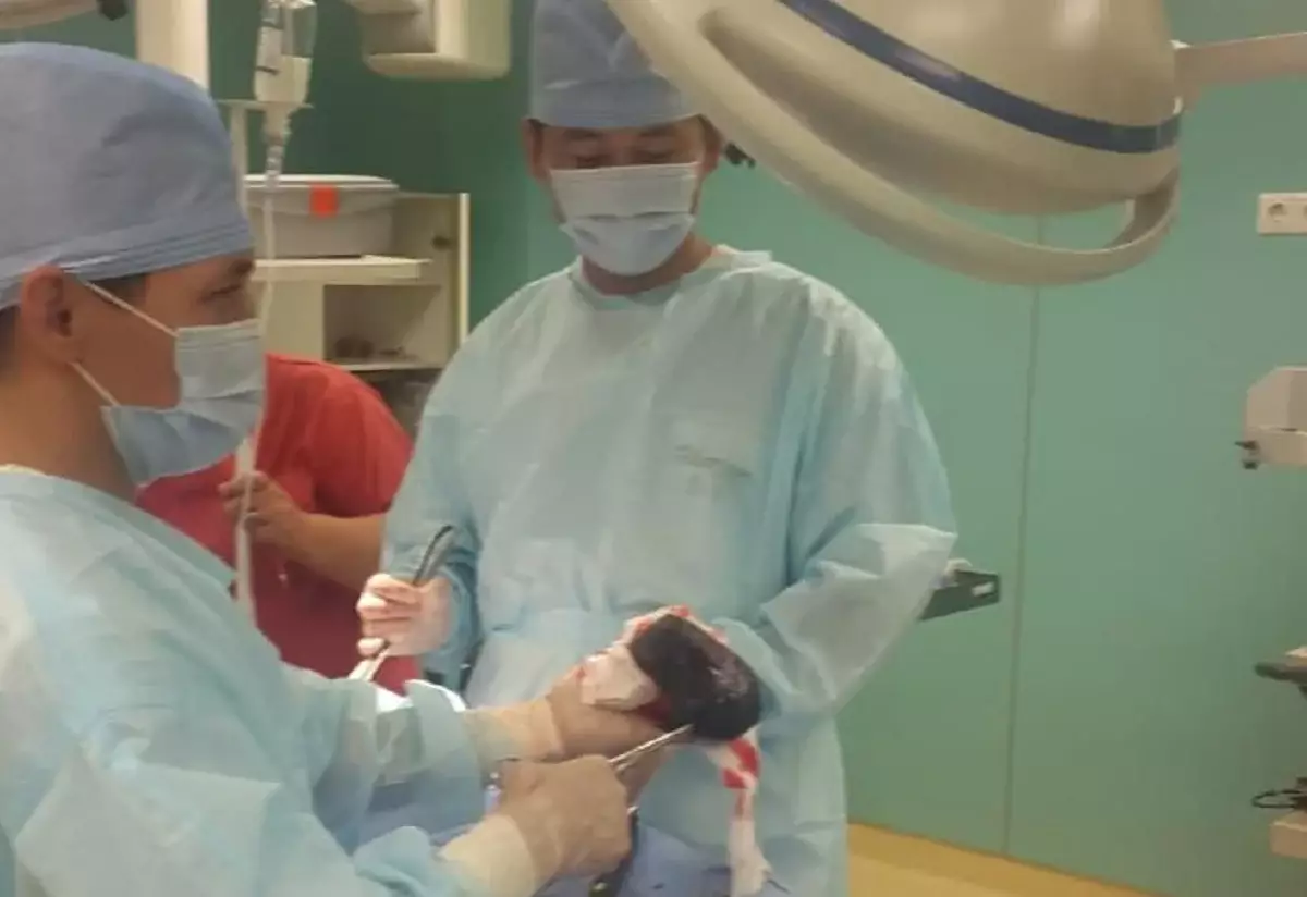 Пациент асқазанында ірі шаш түйіні жиналған: №4 ауруханада сирек ота жасалды