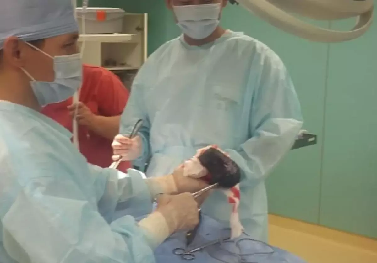 В желудке пациентки несколько лет находился волосяной ком — в ГКБ №4 провели сложную операцию