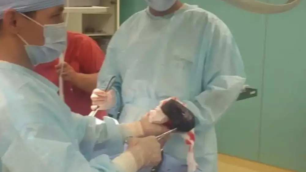 Огромный трихобезоар вытащили из желудка пациентки в Алматы