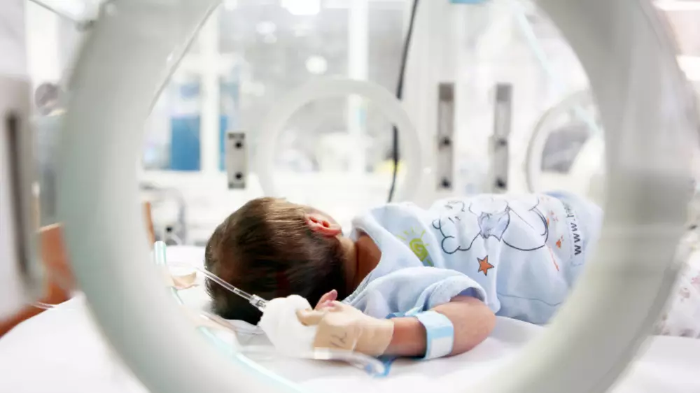 В Алматы родилась девочка весом 730 граммов