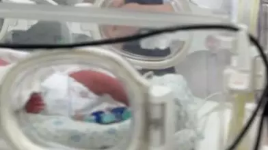 Алматы дәрігерлері салмағы 730 грамм жаңа туған сәбидің өмірін сақтап қалды