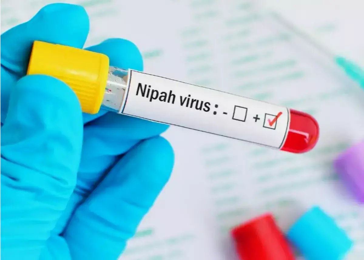 Названы страны, в которых циркулирует вирус Нипах - новости на Lada.kz 08.02.2026