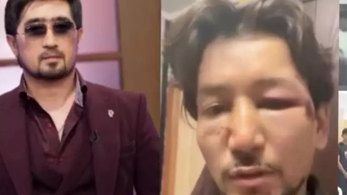 Мұқасан Шахзадаевтан таяқ жеген жігіт жұрт білмейтін шындықты жайып салды