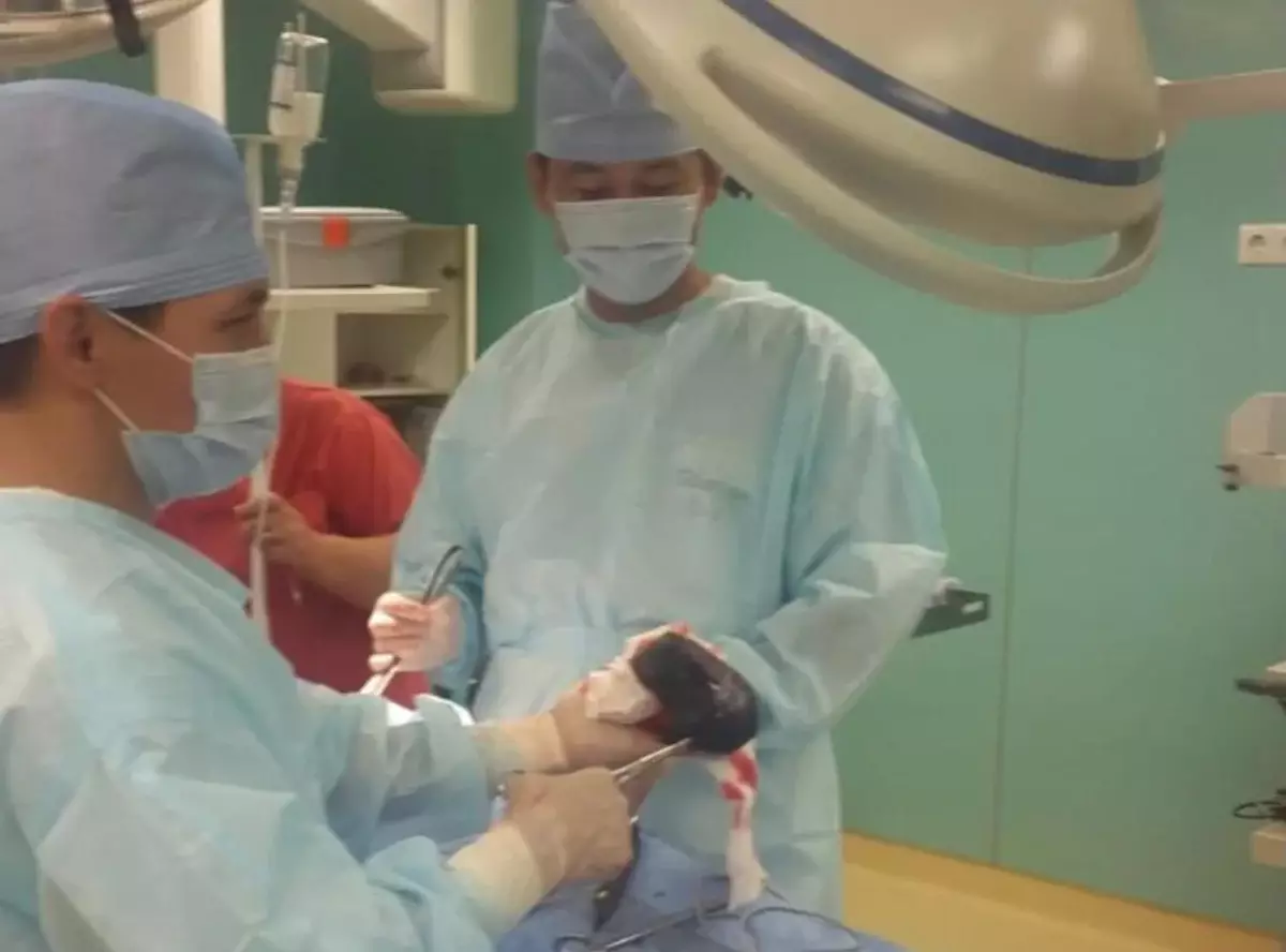 Жительница Алматы пять лет жевала волосы и оказалась у хирургов с огромным комом в желудке