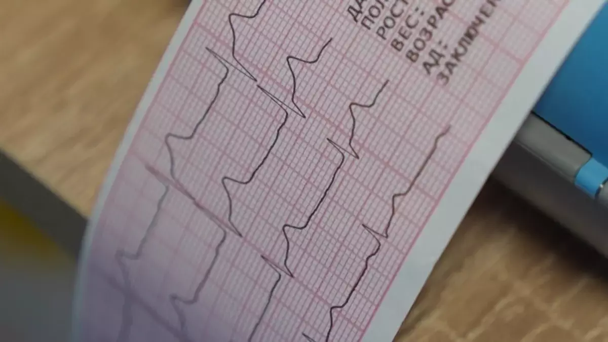 Соңғы жылдары елімізде 16 мың адамға инфаркт диагнозы қойылған