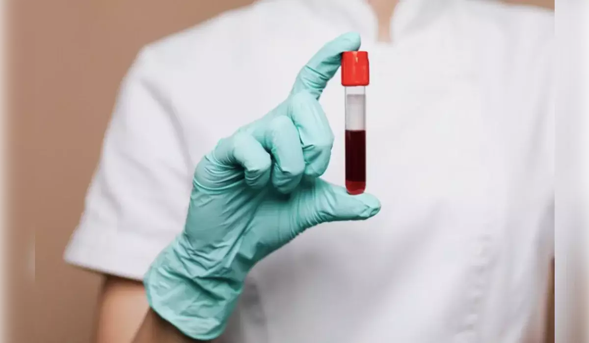 80 тысяч пациентов ежегодно получают донорскую кровь в Казахстане