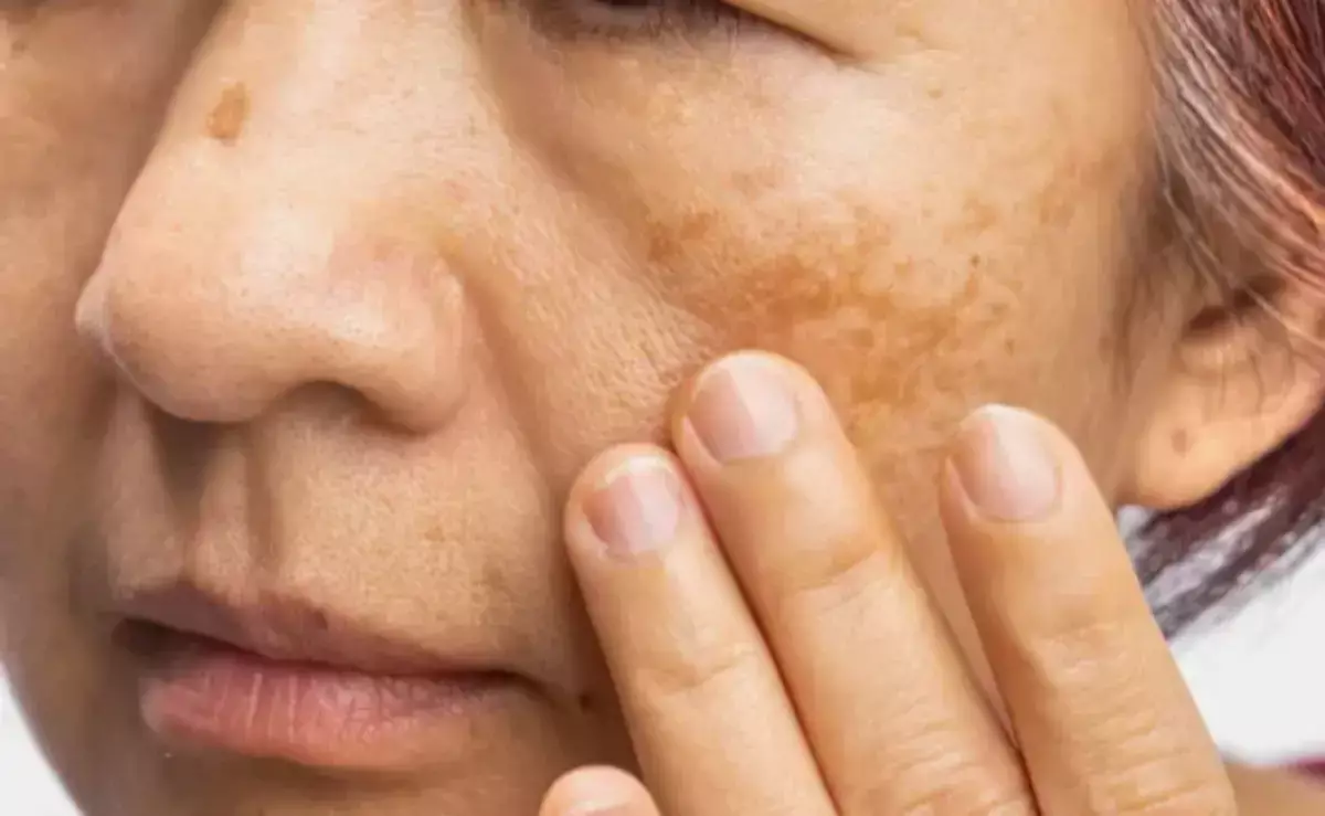 Названо средство, которое поможет убрать пигментацию и замедлить старение кожи - новости на Lada.kz 11.02.2026